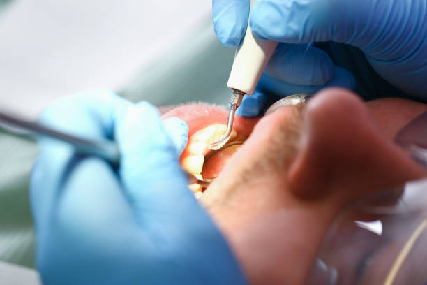 Best Emergency Treatment for Toothache in Manton, MI