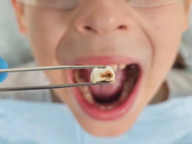 Best Emergency Dental Surgery in Manton, MI